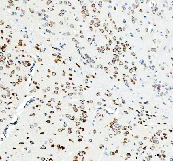 Figure 3. IHC analysis of RPL7A using anti-RPL7A antibody (M08246-1). RPL7A was detected in a paraffin-embedded section of mouse brain tissue. Heat mediated antigen retrieval was performed in EDTA buffer (pH 8.0, epitope retrieval solution). The tissue section was blocked with 10% goat serum. The tissue section was then incubated with 1:50 rabbit anti-RPL7A Antibody (M08246-1) overnight at 4°C. Peroxidase Conjugated Goat Anti-rabbit IgG was used as secondary antibody and incubated for 30 minutes at 37°C. The tissue section was developed using HRP Conjugated Rabbit IgG Super Vision Assay Kit (Catalog # SV0002) with DAB as the chromogen.