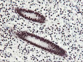 m08258 anti hoxc11 mouse monoclonal antibody clone id oti3e10 ihc testing 4
