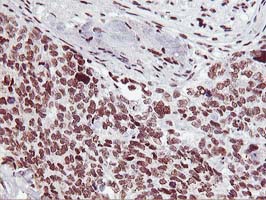m08258 anti hoxc11 mouse monoclonal antibody clone id oti3e10 ihc testing 7