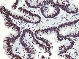 m08258 anti hoxc11 mouse monoclonal antibody clone id oti3e10 ihc testing 8