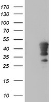 HEK293T cells were transfected with the pCMV6-ENTRY control (Left lane) or pCMV6-ENTRY HOXC11 (Right lane) cDNA for 48 hrs and lysed