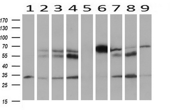 Western blot analysis of extracts (10ug) from 9 Human tissue by using anti-HOXC11 monoclonal antibody at 1:200 (1: Testis; 2: Omentum; 3: Uterus; 4: Breast; 5: Brain; 6: Liver; 7: Ovary; 8: Thyroid gland; 9: colon)