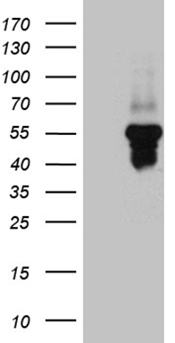 HEK293T cells were transfected with the pCMV6-ENTRY control (Left lane) or pCMV6-ENTRY SERPINI1 (Right lane) cDNA for 48 hrs and lysed