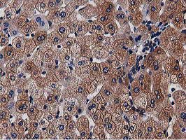m08301 anti nudt6 mouse monoclonal antibody clone id oti9d12 ihc testing 10