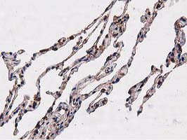 m08301 anti nudt6 mouse monoclonal antibody clone id oti9d12 ihc testing 11