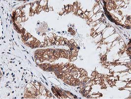 m08301 anti nudt6 mouse monoclonal antibody clone id oti9d12 ihc testing 2