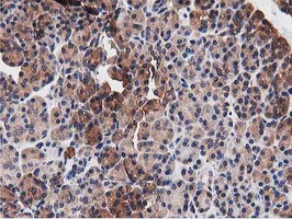 m08301 anti nudt6 mouse monoclonal antibody clone id oti9d12 ihc testing 3
