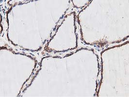 m08301 anti nudt6 mouse monoclonal antibody clone id oti9d12 ihc testing 4