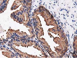 m08301 anti nudt6 mouse monoclonal antibody clone id oti9d12 ihc testing 5