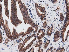 m08301 anti nudt6 mouse monoclonal antibody clone id oti9d12 ihc testing 6