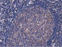 m08301 anti nudt6 mouse monoclonal antibody clone id oti9d12 ihc testing 7