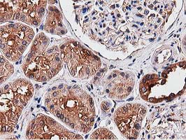 m08301 anti nudt6 mouse monoclonal antibody clone id oti9d12 ihc testing 9