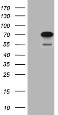 HEK293T cells were transfected with the pCMV6-ENTRY control (Left lane) or pCMV6-ENTRY CEP72 (Right lane) cDNA for 48 hrs and lysed
