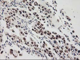 m08313 anti tfiif gtf2f1 mouse monoclonal antibody clone id oti4b10 ihc testing 3