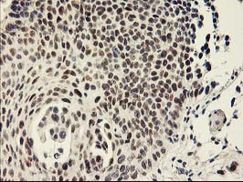 m08313 anti tfiif gtf2f1 mouse monoclonal antibody clone id oti4b10 ihc testing 5