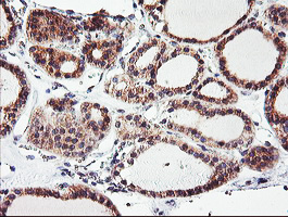 m08322 anti camlg mouse monoclonal antibody clone id oti1a3 ihc testing 2