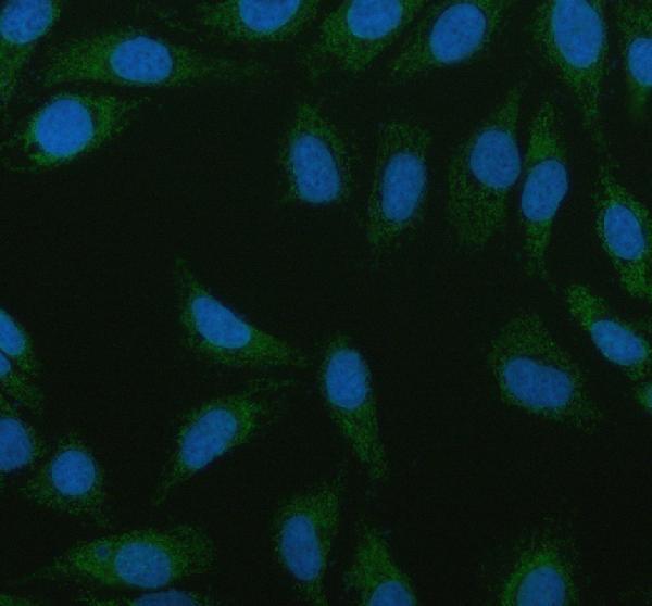 m08341 1 acaa2 primary antibodies if testing 6