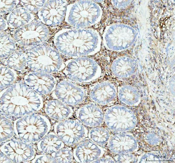 m08341 1 acaa2 primary antibodies ihc testing 2