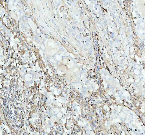 m08341 1 acaa2 primary antibodies ihc testing 3
