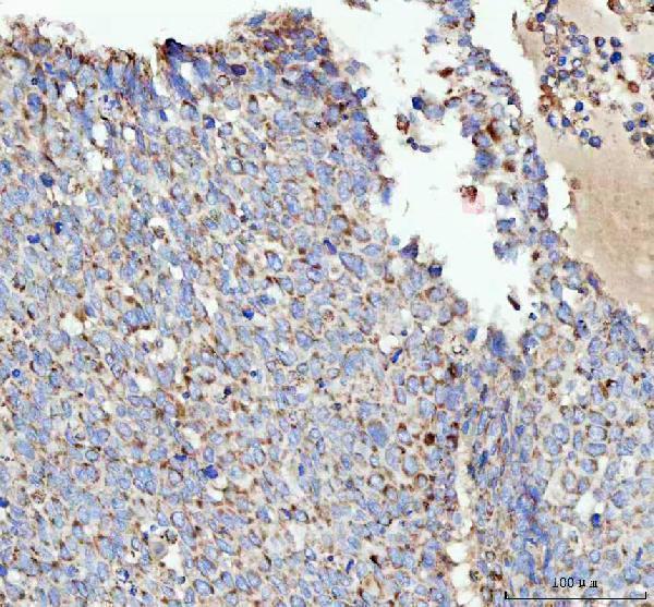 m08341 1 acaa2 primary antibodies ihc testing 4
