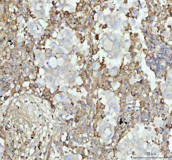 m08341 1 acaa2 primary antibodies ihc testing 5