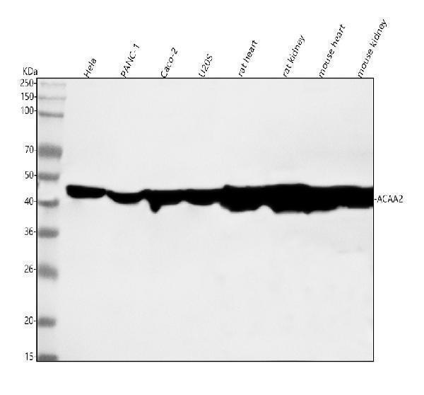 m08341 1 acaa2 primary antibodies wb testing 1_1