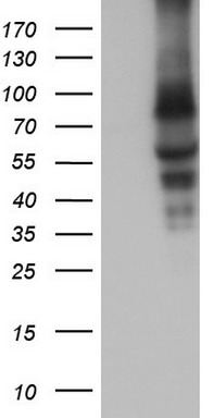m08350 1 anti calpain 5 capn5 mouse monoclonal antibody clone id oti4h5 wb testing 1