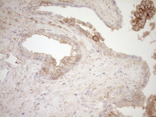 m08350 anti calpain 5 capn5 mouse monoclonal antibody clone id oti7d2 ihc testing 1