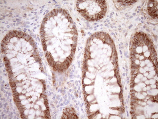 m08350 anti calpain 5 capn5 mouse monoclonal antibody clone id oti7d2 ihc testing 2
