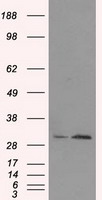 HEK293T cells were transfected with the pCMV6-ENTRY control (Left lane) or pCMV6-ENTRY TIPRL (Right lane) cDNA for 48 hrs and lysed