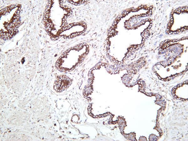 Human prostate was stained with anti-TUBA1B rabbit antibody