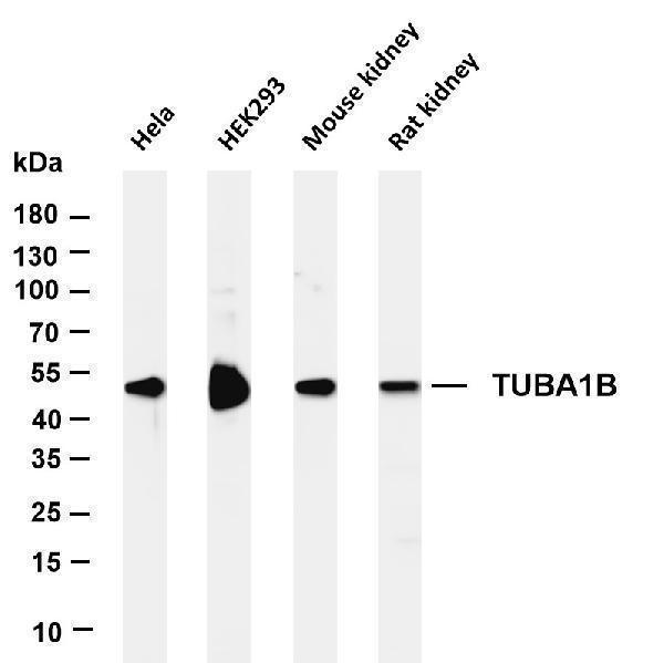 m08382 7 tuba1b primary antibodies wb testing 1