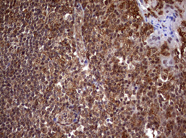 m08401 anti usp44 mouse monoclonal antibody clone id oti1d1 ihc testing 11