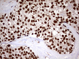 m08401 anti usp44 mouse monoclonal antibody clone id oti1d1 ihc testing 12