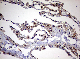 m08401 anti usp44 mouse monoclonal antibody clone id oti1d1 ihc testing 16