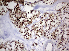 m08401 anti usp44 mouse monoclonal antibody clone id oti1d1 ihc testing 5