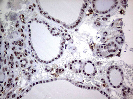 m08401 anti usp44 mouse monoclonal antibody clone id oti1d1 ihc testing 6