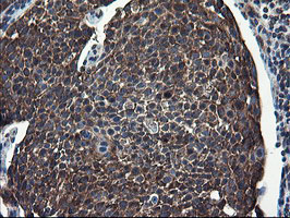 m08405 2 anti cnot4 mouse monoclonal antibody clone id oti1h2 ihc testing 10