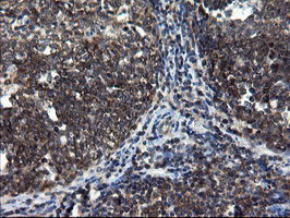m08405 2 anti cnot4 mouse monoclonal antibody clone id oti1h2 ihc testing 11