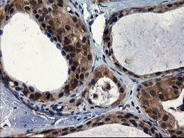 m08405 2 anti cnot4 mouse monoclonal antibody clone id oti1h2 ihc testing 12
