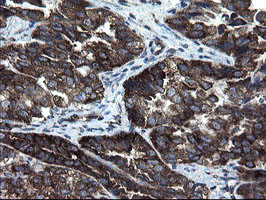 m08405 2 anti cnot4 mouse monoclonal antibody clone id oti1h2 ihc testing 3