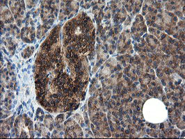 m08405 2 anti cnot4 mouse monoclonal antibody clone id oti1h2 ihc testing 4