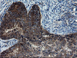 m08405 2 anti cnot4 mouse monoclonal antibody clone id oti1h2 ihc testing 7