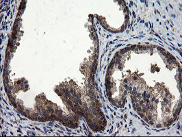 m08405 2 anti cnot4 mouse monoclonal antibody clone id oti1h2 ihc testing 8