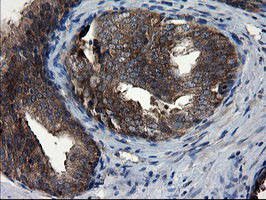 m08405 2 anti cnot4 mouse monoclonal antibody clone id oti1h2 ihc testing 9