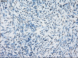 Immunohistochemical staining of paraffin-embedded Ovary tissue within the normal limits using anti-NAT8mouse monoclonal antibody