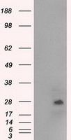 HEK293T cells were transfected with the pCMV6-ENTRY control (Left lane) or pCMV6-ENTRY NAT8 (Right lane) cDNA for 48 hrs and lysed