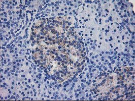Immunohistochemical staining of paraffin-embedded Human pancreas tissue within the normal limits using anti-IFI35 mouse monoclonal antibody