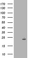 HEK293T cells were transfected with the pCMV6-ENTRY control (Left lane) or pCMV6-ENTRY IFI35 (Right lane) cDNA for 48 hrs and lysed