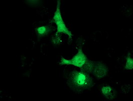 m08421 anti lcmt1 mouse monoclonal antibody clone id oti4a5 if testing 13